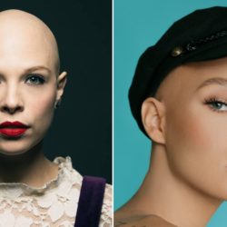 Six Women Open Up About How Having Alopecia Changed Their Outlooks on Beauty